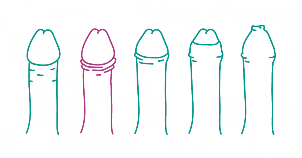 Dickpic - Dein Schwanz als Comic